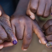 mountaintop-rotary-polio-hands